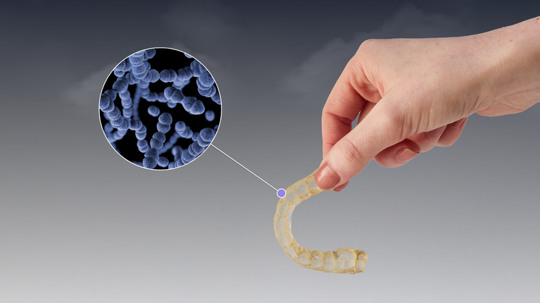 The Link between Dirty Retainers and Poor Sleep