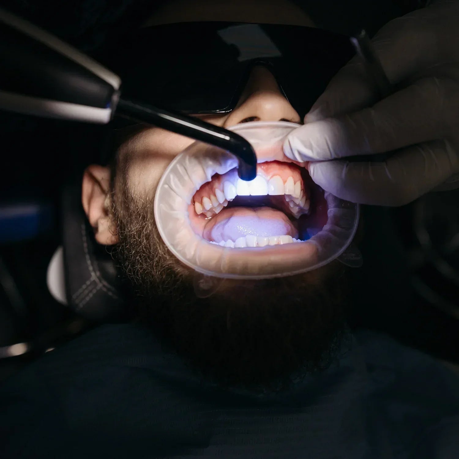 Why doesn't the Dental pod have a UV light? (2026)
